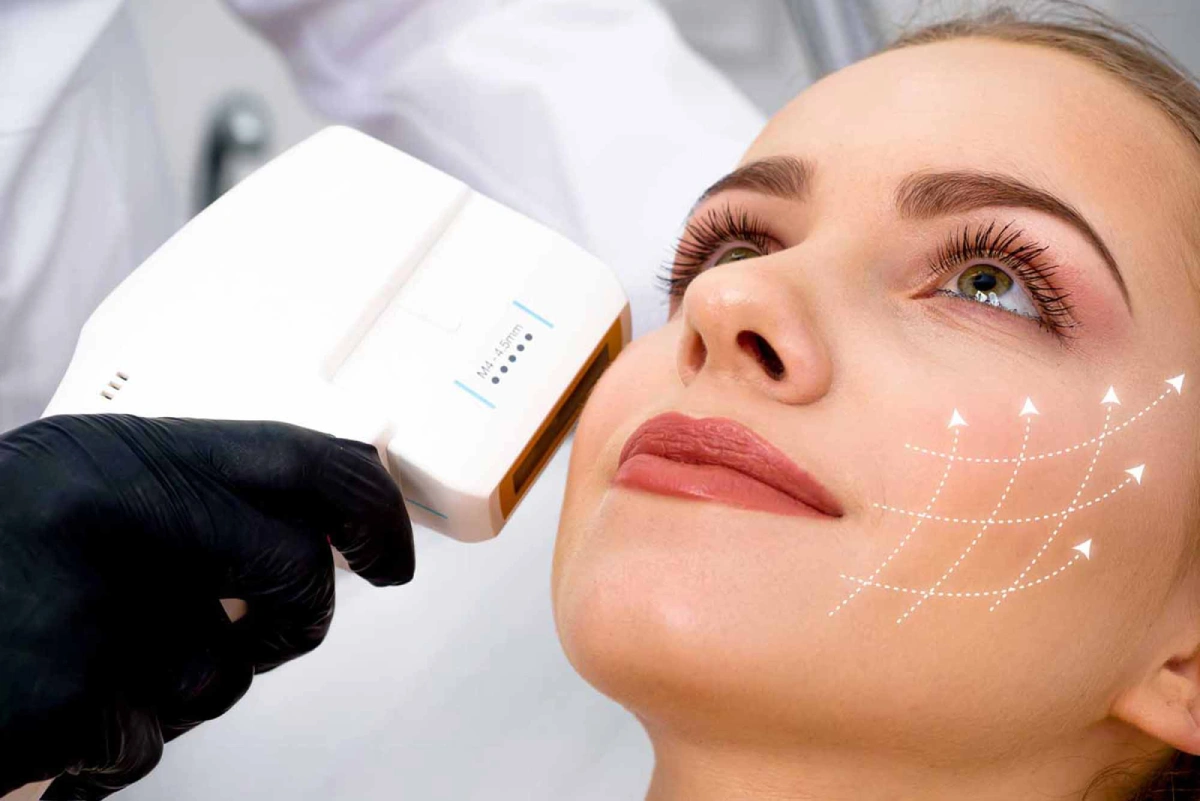 HIFU: Using Ultrasound to Boost Collagen
