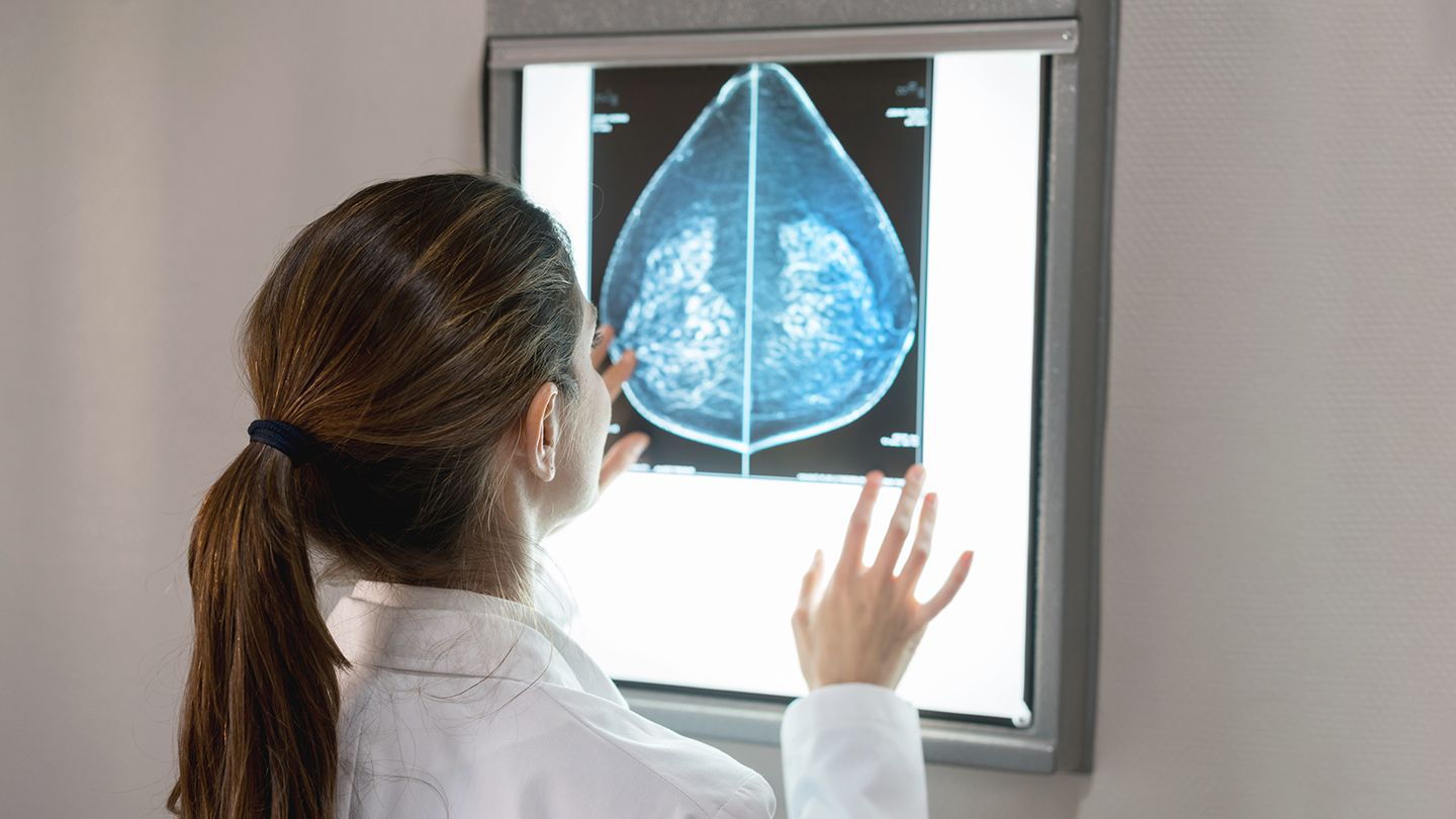 Understanding Breast Cancer Testing: What to Expect and How It Works