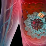 symptoms of high prolactin in females