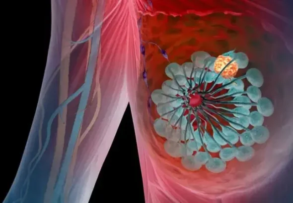 symptoms of high prolactin in females