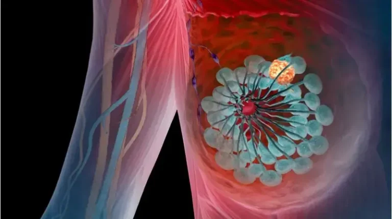 symptoms of high prolactin in females