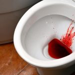 why am i pooping blood no pain