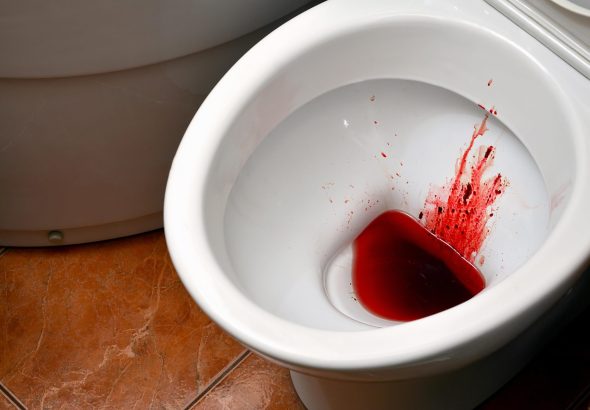 why am i pooping blood no pain