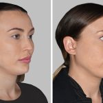 article_32490025_featured_1776493514