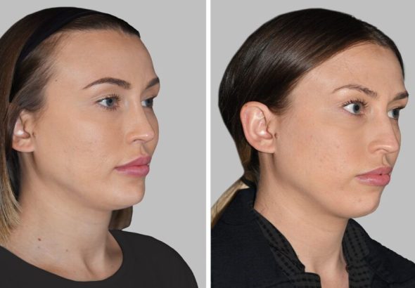 article_32490025_featured_1776493514