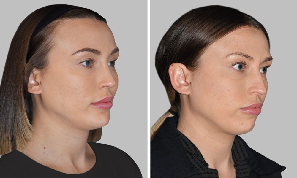 article_32490025_featured_1776493514