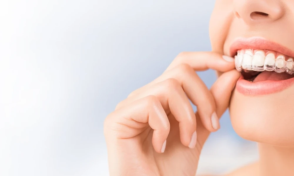 Post Treatment Smile Maintenance: When To Replace A Retainer And Why